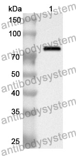 Anti-HSPA1A Polyclonal Antibody