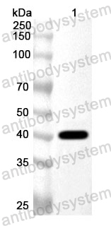 Anti-Human ZBTB48 Polyclonal Antibody