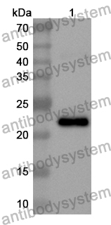 Anti-GAA Polyclonal Antibody