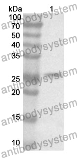 Anti-BCL2 Polyclonal Antibody