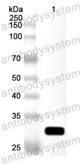 Anti-Human UROS Polyclonal Antibody