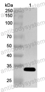 Anti-Human SLC2A1 Polyclonal Antibody