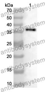 Anti-PDHB Polyclonal Antibody