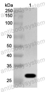 Anti-Human DBT/BCOADC-E2 Polyclonal Antibody