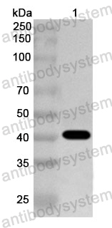 Anti-Human PYGM Polyclonal Antibody