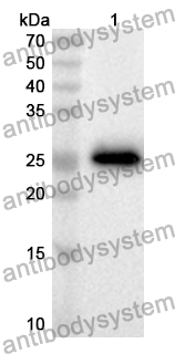 Anti-Human MBL2/MBP-C Polyclonal Antibody
