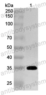 Anti-Human NAT2 Polyclonal Antibody