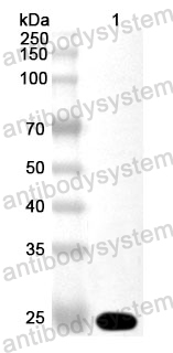 Anti-Human SLC25A4 Polyclonal Antibody