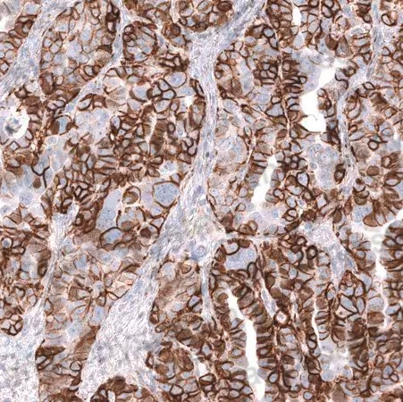 Immunohistochemical for Anti-CD56/NCAM1 Polyclonal Antibody ?>