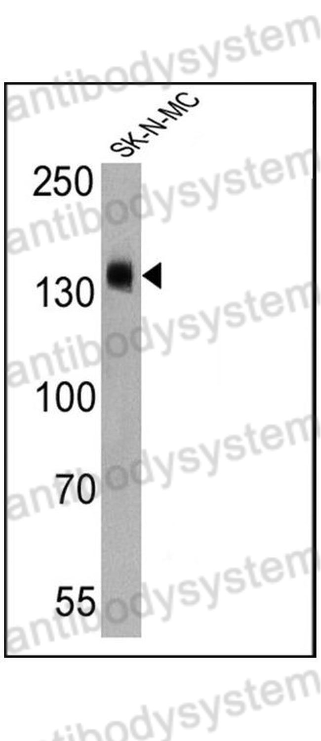 Western Blot for Anti-CD56/NCAM1 Polyclonal Antibody ?>