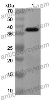 Anti-KRT13 Polyclonal Antibody
