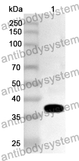 Anti-Human PTPN22 Polyclonal Antibody