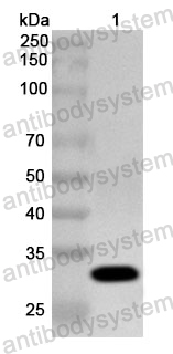Anti-Human APEH Polyclonal Antibody