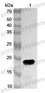 Anti-Human PRKAR2A Polyclonal Antibody