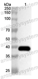 Anti-Human EDN3 Polyclonal Antibody