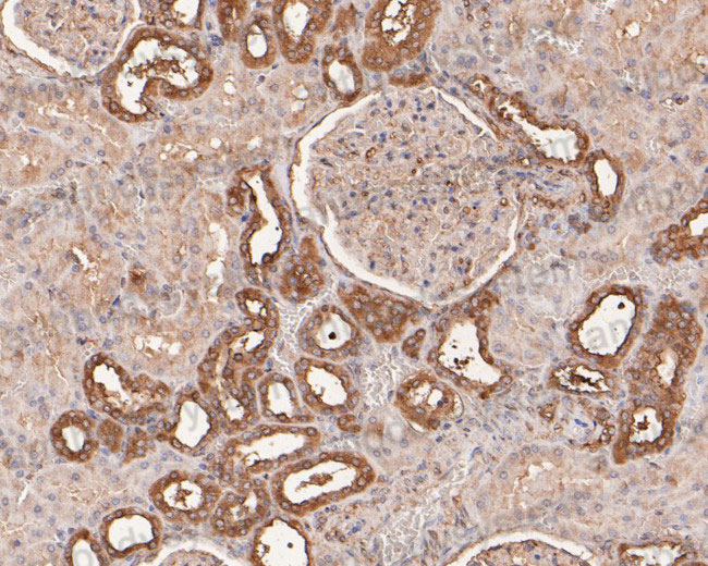 Immunohistochemical for Anti-Human PRKCSH Polyclonal Antibody ?>