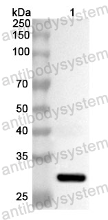 Anti-Human PGAM2 Polyclonal Antibody