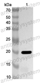 Anti-Human HTN3 Polyclonal Antibody