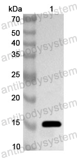Anti-Human PAX1 Polyclonal Antibody