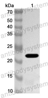 Anti-Human RPS2 Polyclonal Antibody
