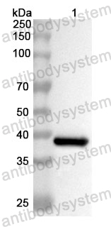 Anti ACAN Polyclonal Antibody
