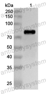 Anti-Human GLB1/Beta-galactosidase Polyclonal Antibody