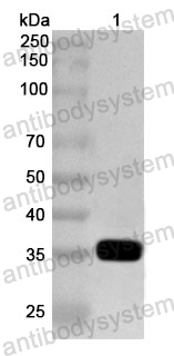 Anti-Human PRKCA Polyclonal Antibody