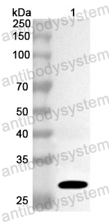Anti-Human BCL3 Polyclonal Antibody