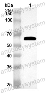 Anti-Human MAOA Polyclonal Antibody