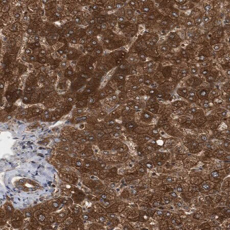 Immunohistochemical for Anti-Human PAICS Polyclonal Antibody ?>