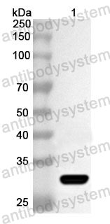 Anti-Human MCC Polyclonal Antibody