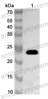 Anti-Human PRPH2 Polyclonal Antibody