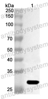 Anti-Human ITGB7 Polyclonal Antibody