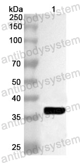 Anti-Human ACRV1 Polyclonal Antibody