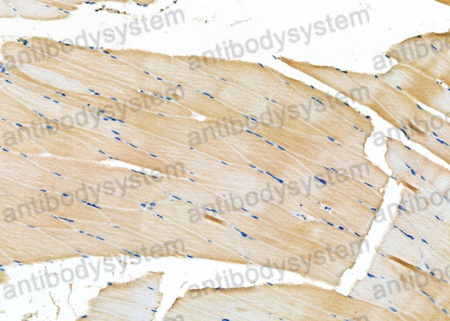 Immunohistochemical for Anti-Human HSD3B2 Polyclonal Antibody ?>