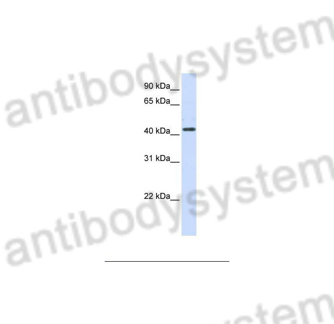 Western Blot for Anti-Human HSD3B2 Polyclonal Antibody ?>
