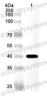 Anti-Human CD121b/IL1R2/IL-2R beta Polyclonal Antibody
