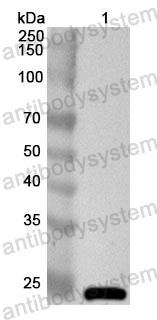 Anti-Human HTR2C Polyclonal Antibody