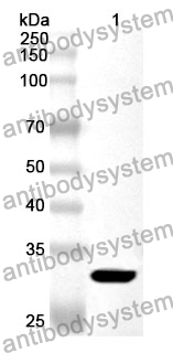 Anti-PCSK1 Polyclonal Antibody