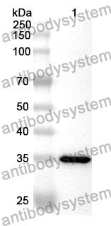 Anti-TKT Polyclonal Antibody