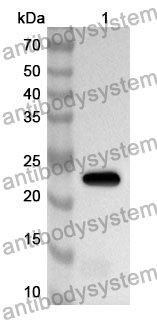 Anti-PKLR Polyclonal Antibody