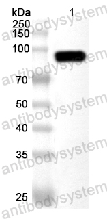 Anti-Human HNRNPH1 Polyclonal Antibody