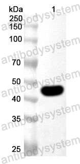 Anti-Human ARRB2 Polyclonal Antibody