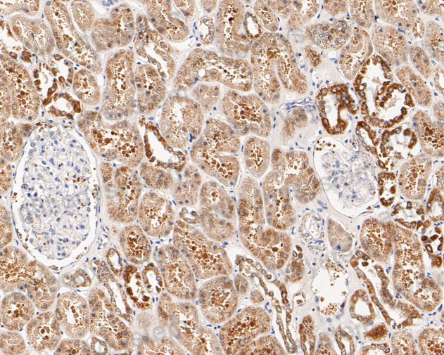 Immunohistochemical for Anti-CHRNA3 Polyclonal Antibody ?>