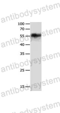 Western Blot for Anti-CHRNA3 Polyclonal Antibody ?>