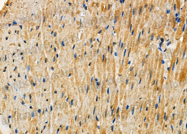 Immunohistochemical for Anti-Human SLC8A1 Polyclonal Antibody ?>