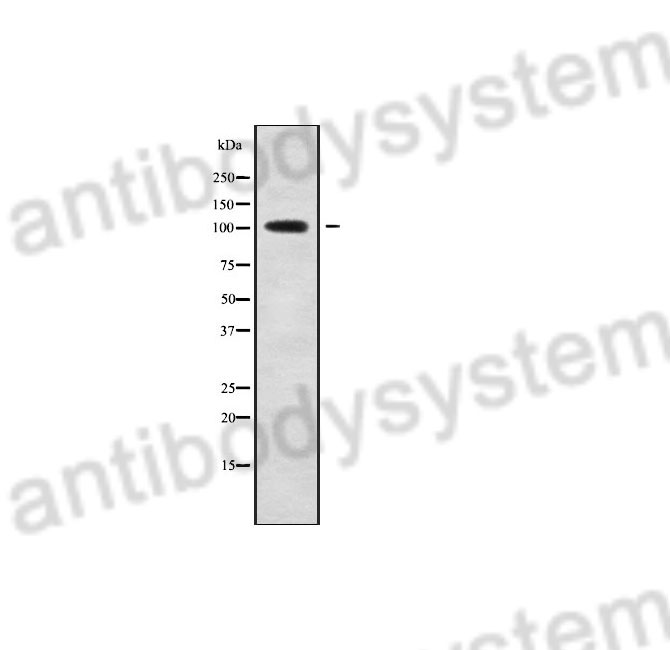 Western Blot for Anti-Human SLC8A1 Polyclonal Antibody ?>