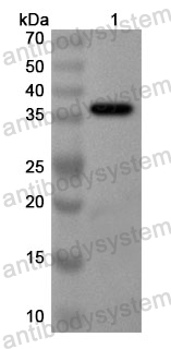 Anti-Human SLC8A1 Polyclonal Antibody