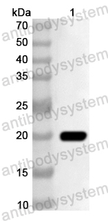 Anti-Human CD70 Polyclonal Antibody