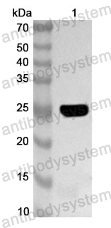 Anti-Human DEK Polyclonal Antibody